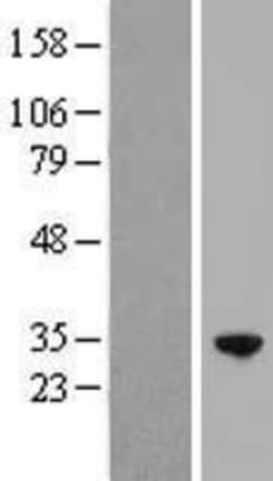 Novus Biologicals™ RFXANK Overexpression Lysate