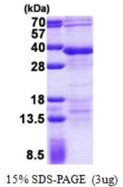 Novus Biologicals&trade;&nbsp;Recombinant Human RFXANK His Protein