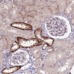 RG9MTD2 Antibody, Novus Biologicals 0.1mL; Unlabeled:Antibodies, Polyclonal