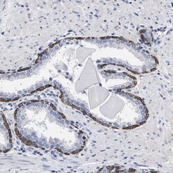 RG9MTD3 Antibody, Novus Biologicals 0.1mL; Unlabeled:Antibodies, Polyclonal