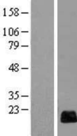 Novus Biologicals™ RGC32 Overexpression Lysate