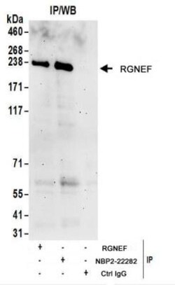 RGNEF Antibody, Novus Biologicals 0.1mg; Unlabeled:Antibodies, Polyclonal