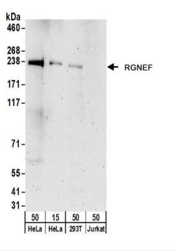 RGNEF Antibody, Novus Biologicals 0.1mg; Unlabeled:Antibodies, Polyclonal