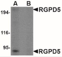 RGPD5 Antibody - BSA Free, Novus Biologicals 0.025 mg, Unlabeled:Antibodies,