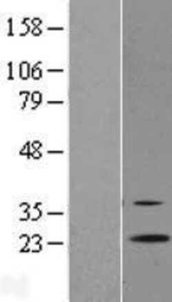 Novus Biologicals&trade;&nbsp;RGR Overexpression Lysate