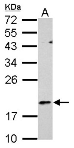 RGS1 Antibody, Novus Biologicals 0.1mL; Unlabeled:Antibodies, Polyclonal