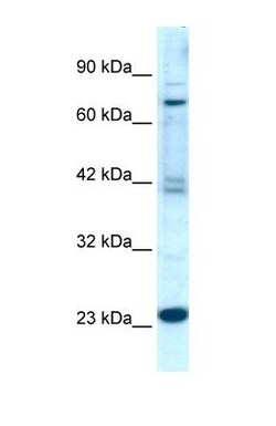RGS10 Antibody, Novus Biologicals 20&mu;L; Unlabeled:Antibodies, Polyclonal
