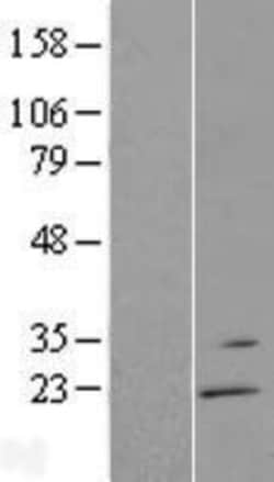 Novus Biologicals™ RGS13 Overexpression Lysate
