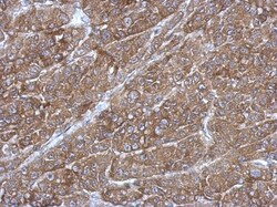 RGS14 Antibody, Novus Biologicals 0.1mL; Unlabeled:Antibodies, Polyclonal