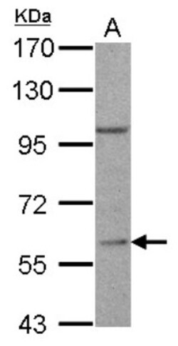 RGS14 Antibody, Novus Biologicals 0.1mL; Unlabeled:Antibodies, Polyclonal