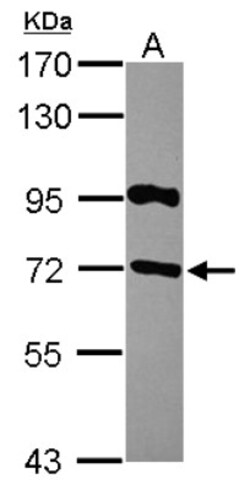 RGS14 Antibody, Novus Biologicals 0.1mL; Unlabeled:Antibodies, Polyclonal