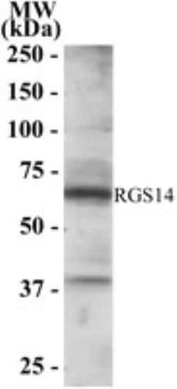 RGS14 Antibody, Novus Biologicals 0.1mg; Unlabeled:Antibodies, Polyclonal