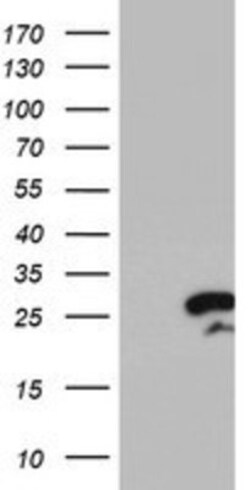 RGS16 Antibody (OTI4E5), Novus Biologicals 0.1mL; Unlabeled:Antibodies,