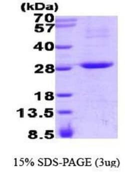 Novus Biologicals&trade;&nbsp;Recombinant Human RGS16 His Protein