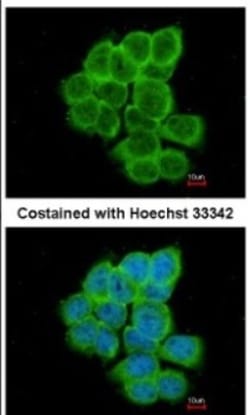 RGS17 Antibody, Novus Biologicals 0.1mg; Unlabeled:Antibodies, Polyclonal