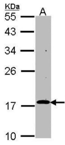 RGS17 Antibody, Novus Biologicals 0.1mg; Unlabeled:Antibodies, Polyclonal