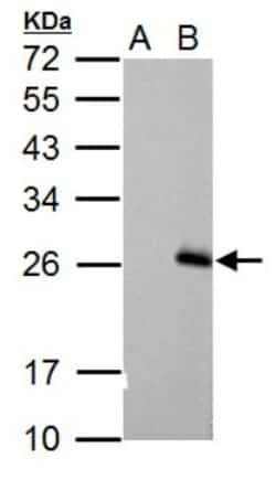 RGS17 Antibody, Novus Biologicals 0.1mg; Unlabeled:Antibodies, Polyclonal