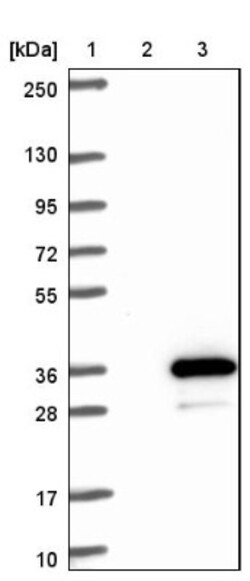 RGS18 Antibody, Novus Biologicals 0.1mL; Unlabeled:Antibodies, Polyclonal