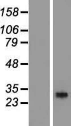 Novus Biologicals&trade;&nbsp;RGS18 Overexpression Lysate