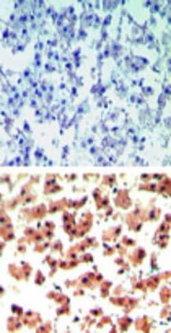RGS19 Antibody, Novus Biologicals 0.1mg; Unlabeled:Antibodies, Polyclonal