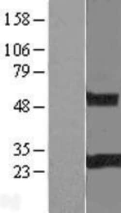 Novus Biologicals&trade;&nbsp;RGS19 Overexpression Lysate