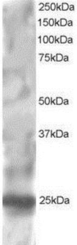RGS1 Antibody, Novus Biologicals 0.1mg; Unlabeled:Antibodies, Polyclonal