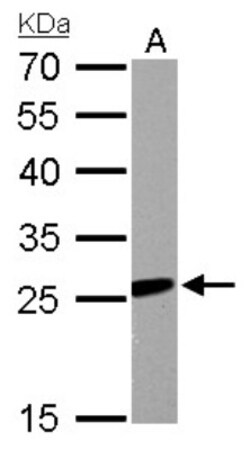 RGS2 Antibody, Novus Biologicals 100 &mu;L | Buy Online | Novus Biologicals | Fisher Scientific