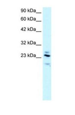 RGS20 Antibody, Novus Biologicals:Antibodies:Primary Antibodies
