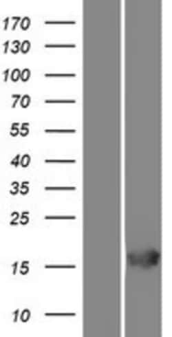 Novus Biologicals&trade;&nbsp;RGS21 Overexpression Lysate