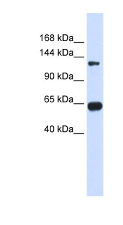 RGS22 Antibody, Novus Biologicals:Antibodies:Primary Antibodies