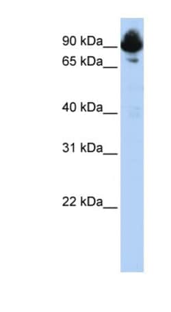 RGS3 Antibody, Novus Biologicals 0.05mg; Unlabeled:Antibodies, Polyclonal