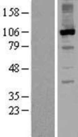Novus Biologicals&trade;&nbsp;RGS3 Overexpression Lysate