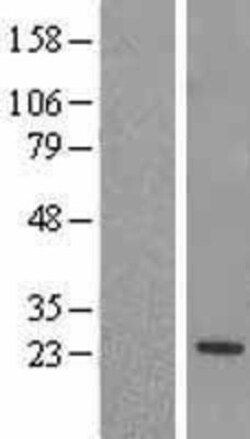 Novus Biologicals™ RGS5 Overexpression Lysate