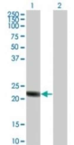 RGS5 Antibody, Novus Biologicals:Antibodies:Primary Antibodies