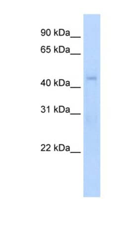 RGS7 Antibody, Novus Biologicals:Antibodies:Primary Antibodies