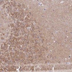 RGS7BP Antibody, Novus Biologicals 25 &mu;L, Unlabeled:Antibodies, Polyclonal
