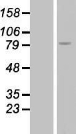 Novus Biologicals&trade;&nbsp;RGS9 Overexpression Lysate