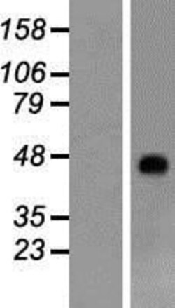 Novus Biologicals&trade;&nbsp;RHAG Overexpression Lysate