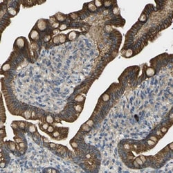 RHBDD1 Antibody, Novus Biologicals:Antibodies:Primary Antibodies