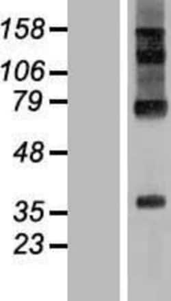 Novus Biologicals&trade;&nbsp;RHBDD2 Overexpression Lysate