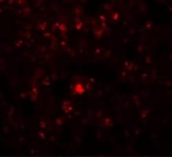 RHBDD2 Antibody - BSA Free, Novus Biologicals 0.025 mg, Unconjugated:Antibodies,