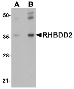 RHBDD2 Antibody - BSA Free, Novus Biologicals:Antibodies:Primary Antibodies