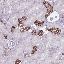 RHBG Antibody, Novus Biologicals 25 &mu;L, Unlabeled:Antibodies, Polyclonal