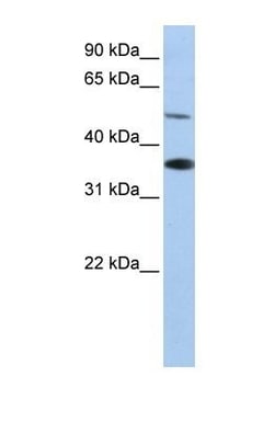 RHBG Antibody, Novus Biologicals 0.05mg; Unlabeled:Antibodies, Polyclonal