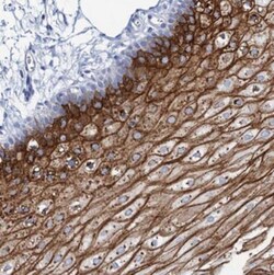 RHCG Antibody, Novus Biologicals:Antibodies:Primary Antibodies