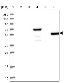 RHCG Antibody, Novus Biologicals 0.1mL; Unlabeled:Antibodies, Polyclonal