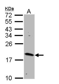 Rheb Antibody, Novus Biologicals 0.1mg; Unlabeled:Antibodies, Polyclonal