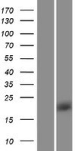 Novus Biologicals&trade;&nbsp;Rheb Overexpression Lysate
