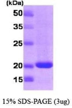 Novus Biologicals Recombinant Human Rheb T7 Protein 0.1 mg | Buy Online | Novus Biologicals&trade; | Fisher Scientific