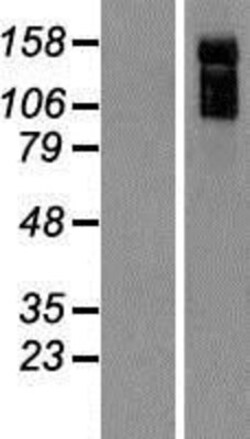 Novus Biologicals&trade;&nbsp;Rho GTPase activating protein 31 Overexpression Lysate